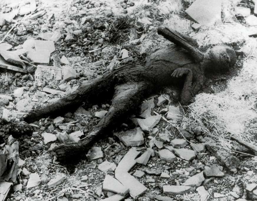 Djelomično spaljeno dijete u Nagasakiju nakon napada atomskom bombom
